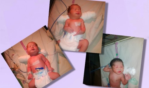 Surrogacy