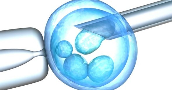 oocyte freezing