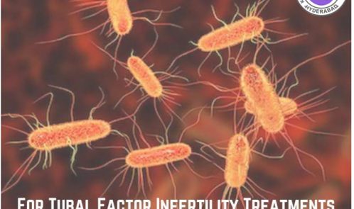 Infertility Treatment in Hyderabad