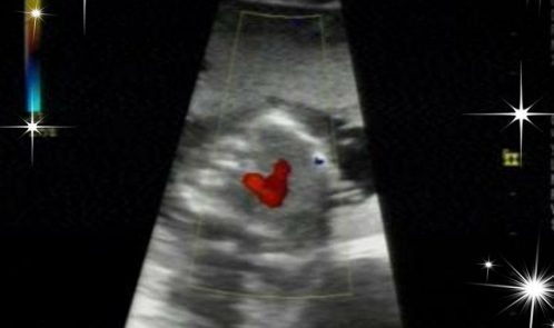 Surrogacy Treatment In Hyderabad