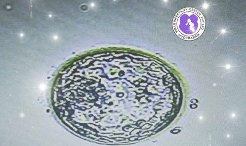 Surrogacy Treatment In Hyderabad