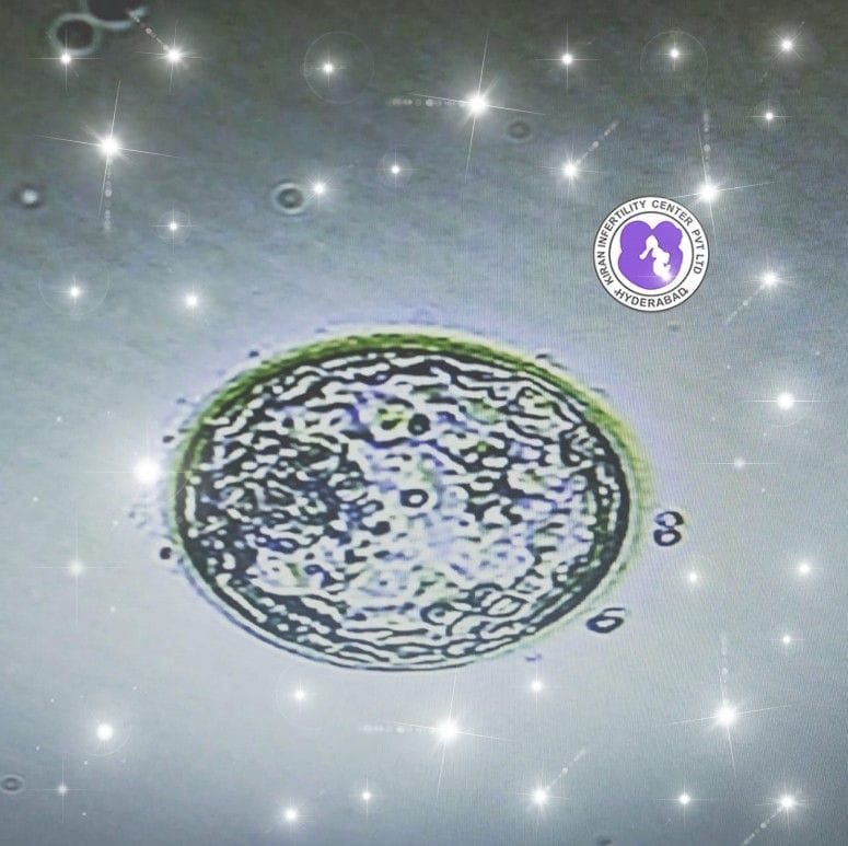 Surrogacy Treatment In Hyderabad