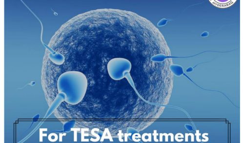ICSI Treatments in Hyderabad