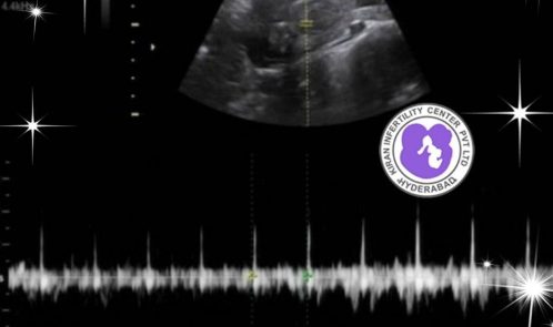Test tube Baby Center in Hyderabad