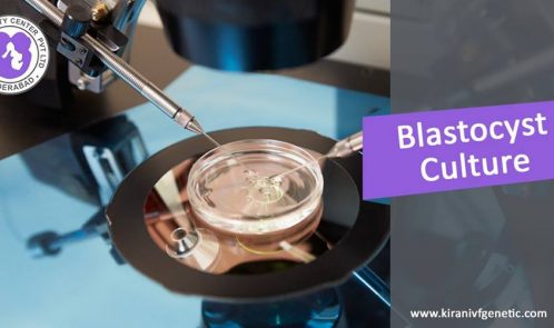 Blastocyst Treatment In Hyderabad