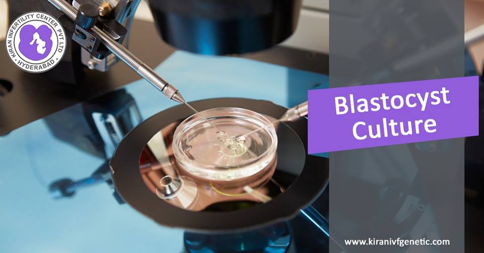 Blastocyst Treatment In Hyderabad