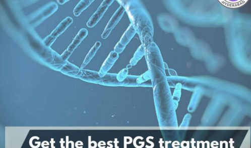 PGS Treatment in Hyderabad