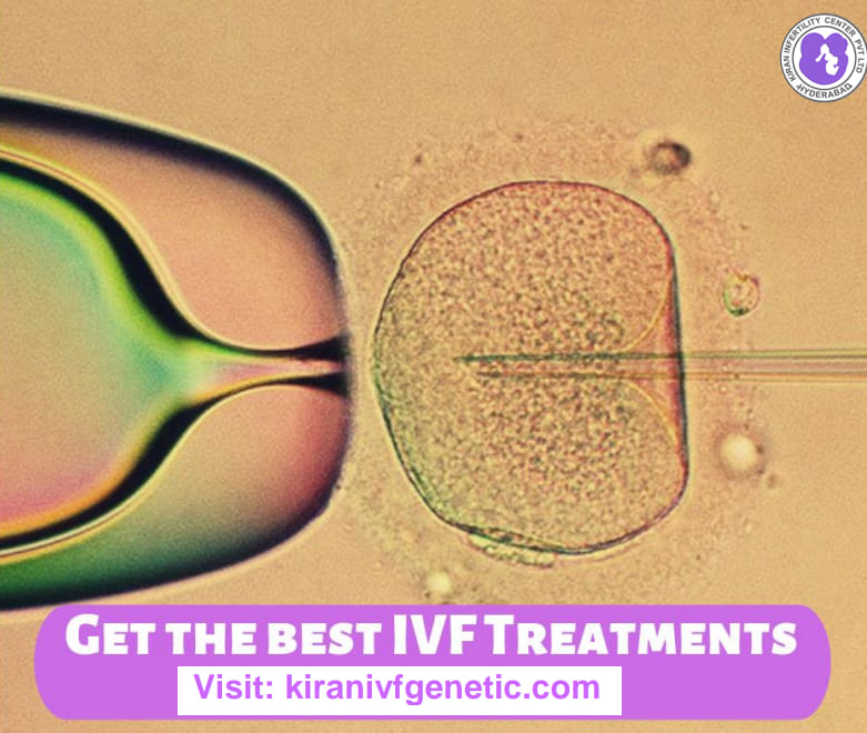 Ivf Treatment in Hyderabad