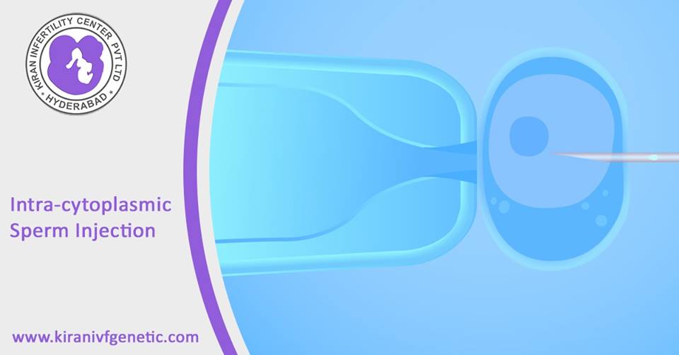 Icsi treatment in hyderabad