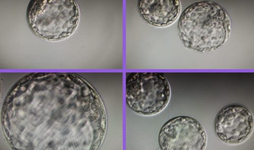 Blastocyst_embryos_treatement-in-hyderabad