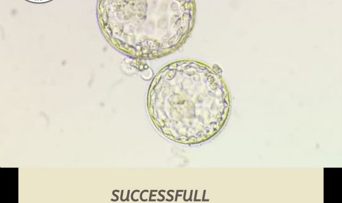 embryo transfer