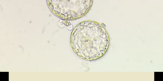 embryo transfer