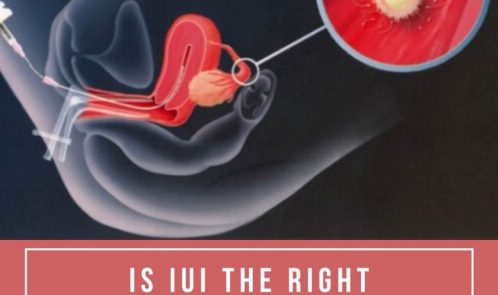 Is IUI The Right Product For You?