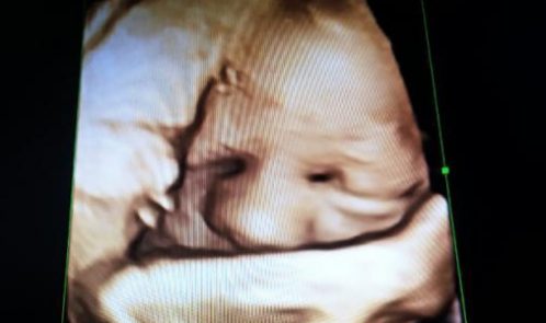 Surrogate_Mother