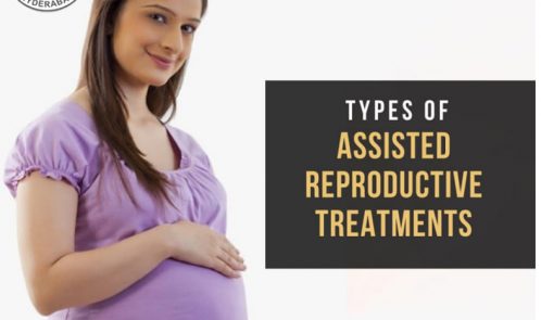 Types of Assisted Reproductive Treatments