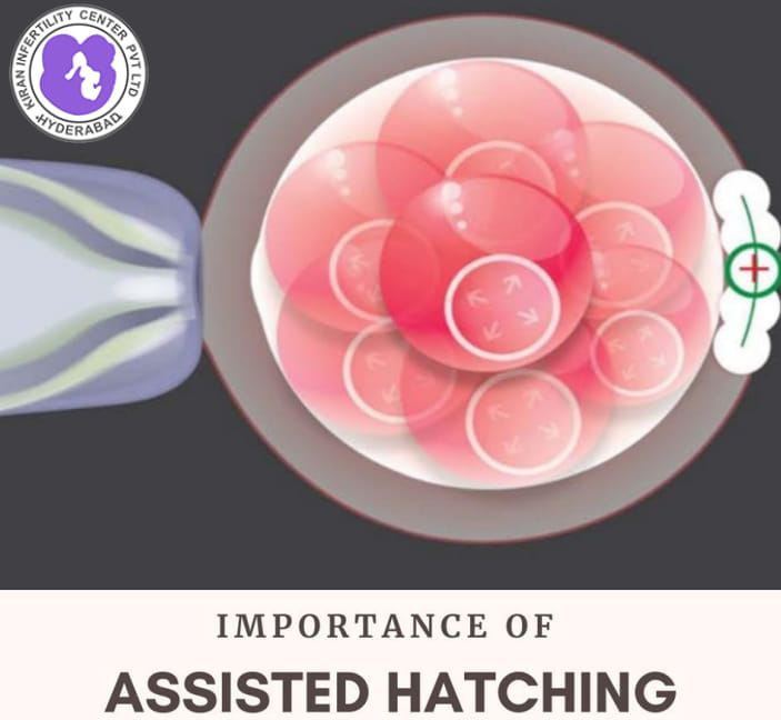 Assisted hatching