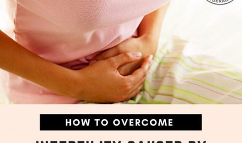 infertility caused by endometriosis