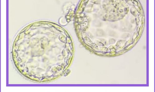 Successful Transfer of Blastocyst Embryos
