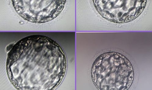 transferred blastocyst embryos