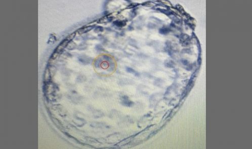 repeated implantation failures