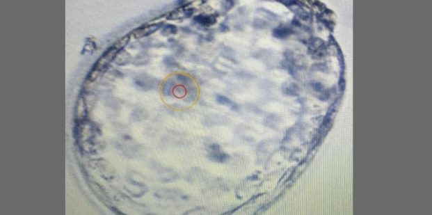 repeated implantation failures
