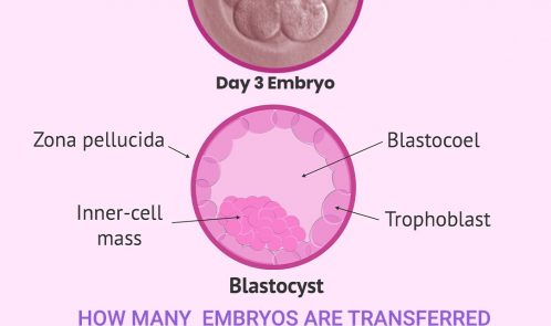 How many embryos should be transferred during IVF?