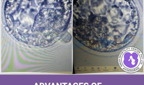 Advantages of Blastocyst Transfer