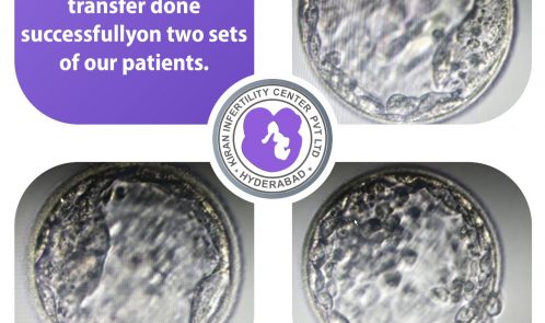 Blastocyst Embryo Transfer