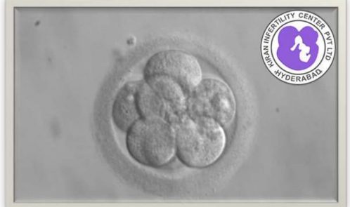 IVF success factors