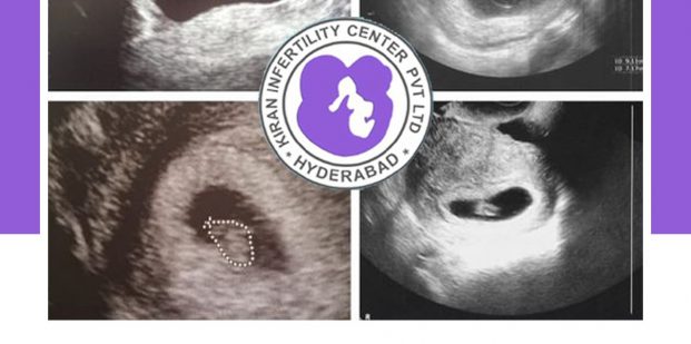 Week By Week Baby Ultrasound