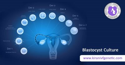 #Blastocyst culture