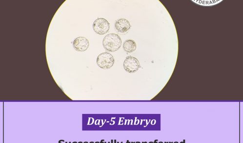 Successfully transferred Day 5 embryos to one of our patients