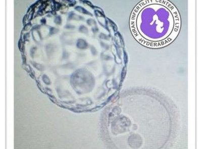 A fully hatched Blastocyst Embryo
