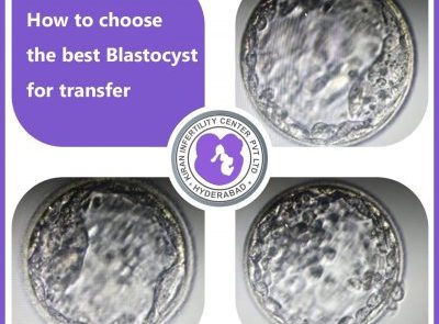 How to choose the best Blastocyst for transfer
