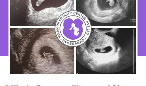 Baby’s growth at 6 weeks pregnant through ultrasound pictures