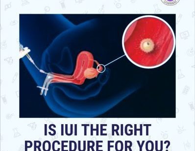 Is Intra Uterine Insemination(IUI) the right procedure for you?