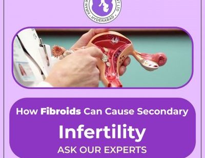 Trash | View KIC Surrogacy —No tags —No comments Published 2020/12/12 3:36:06 pm No title No description Select Fibroids is the precursor to secondary infertility Fibroids is the precursor to secondary infertility