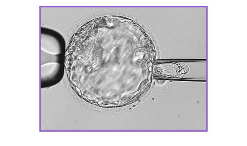 day 5 embryo biopsy