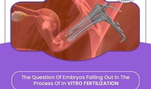 embryo transfer