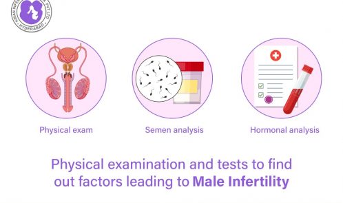 Physical examination and tests to find out factors leading to male infertility