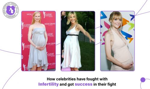celebrities