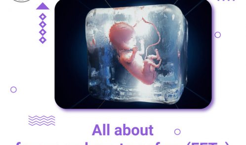Frozen embryo transfer