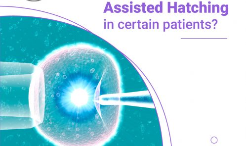 assisted hatching