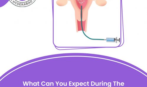 iui