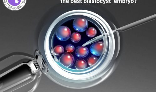Are there any advantages of transferring the best blastocyst embryo