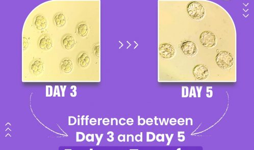 Difference between Day 3 and day 5 Embryo Transfer