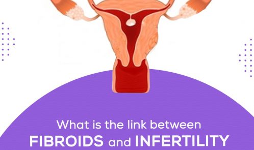 What is the link between fibroids and infertility in women of fertile age?