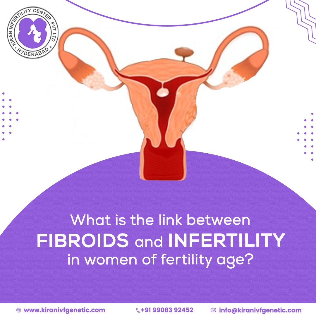 fibroids-and-infertility