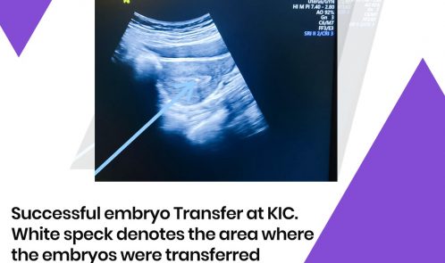 Exciting news to share!!! Successful embryo transfer at KIC