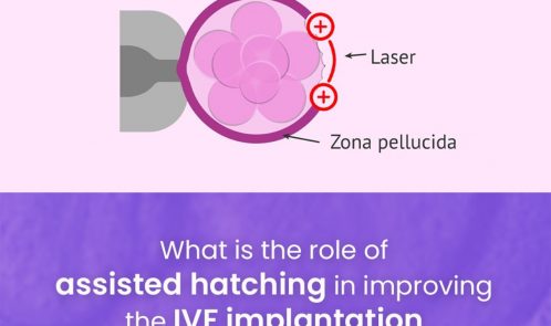 What is the role of Assisted hatching in improving the IVF implantation rates in woman